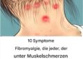 10 Symptome von Fibromyalgie, die jeder mit Muskelschmerzen lesen sollte