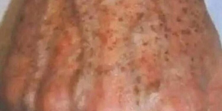 Warum bilden sich Flecken auf den Händen und wie kann man sie entfernen?