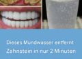 So bekommen Sie weiße Zähne: 15 Tipps für ein schönes Lächeln