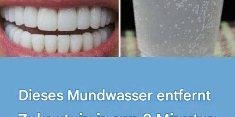 So bekommen Sie weiße Zähne: 15 Tipps für ein schönes Lächeln