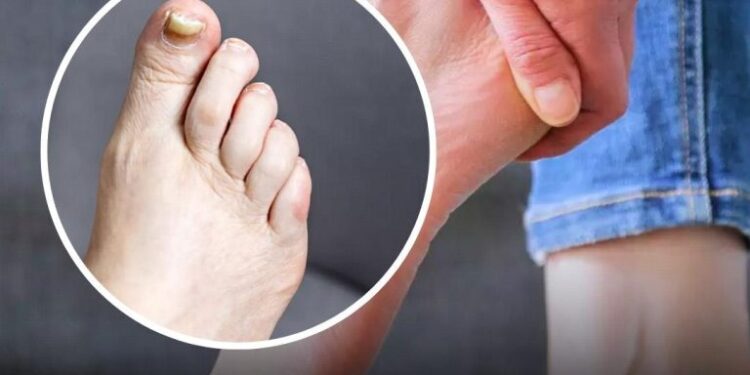 Ein Apotheker enthüllt zwei Warnzeichen für einen stillen Mörder, die Sie an Ihren Füßen erkennen könnten