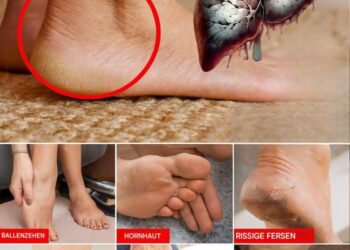 Deine Füße schreien nach Aufmerksamkeit: 6 schockierende Gesundheitshinweise, die in deinen Sohlen versteckt sind