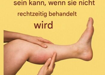 Die 6 besten Infusionen für gesunde Arterien