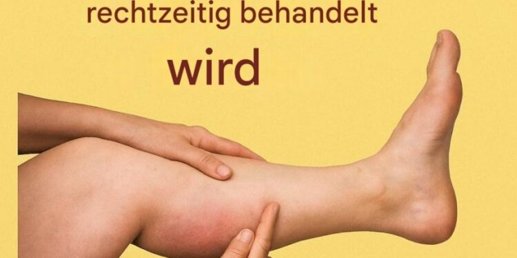 Die 6 besten Infusionen für gesunde Arterien