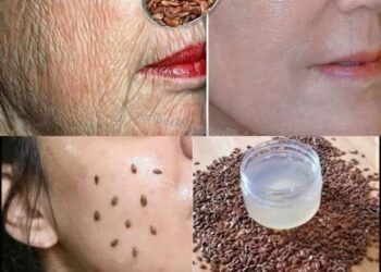 Auch wenn Sie 70 Jahre alt sind, tragen Sie es auf Falten auf: Es wird Ihr Gesicht glasfester machen! Stärker als Botox