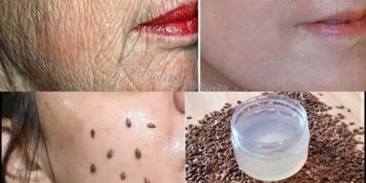 Auch wenn Sie 70 Jahre alt sind, tragen Sie es auf Falten auf: Es wird Ihr Gesicht glasfester machen! Stärker als Botox