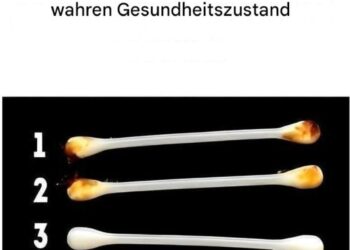 Unsere Ohren verraten den wahren Zustand unserer Gesundheit