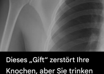 Dieses „Gift“ schädigt Ihre Knochen – und Sie trinken es jeden Tag